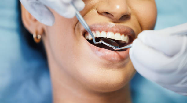Best Emergency Dental Care for Broken or Chipped Teeth in Foley, MN